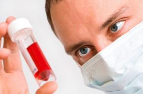 HIV in the United States: At A Glance